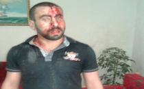 Zabıtanın Görevi Tutanak Tutmaktır, Vurmaya Hakkı Yoktur!